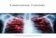 Tuberculosis Tutorials - GitHub Pages · Tuberculosis(TB)Tutorials 1 Tuberculosis(TB)Tutorials Inaseriesoftutorials,eachTB-specificfeatureisexplored,allowingthemodelertobecomeacquain-