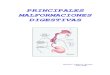PRINCIPALES MALFORMACIONES DIGESTIVASneonatos.org/DOCUMENTOS/Malformaciones_digestivas.pdf · Principales malformaciones digestivas. A. Cuñarro Alonso. Fig. 4: Tipos de atresia de