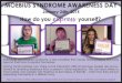 Moebius Awareness Postcard - Oregon State U .What is Moebius Syndrome? Moebius Syndrome is a rare,