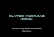 SCANNER THORACIQUE NORMAL - … · SCANNER THORACIQUE NORMAL Marie-Pierre Debray, Nicoletta Pasi, Yaël Amar Hôpital Bichat