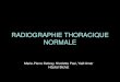 RADIOGRAPHIE THORACIQUE NORMALE - P2 .RADIOGRAPHIE THORACIQUE NORMALE Marie-Pierre Debray, Nicoletta