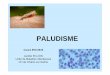 2016 - Paludisme - IFSI DIJON Bienvenue · Traitement de l’accès palustre grave • REANIMATION • En urgence : Artésunate (Malacef®) IVL 3 jours, puis si possible relais PO