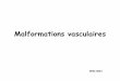 Malformations vasculaires - college- .Classification Malformations vasculaires Malformations Flux