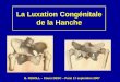 La Luxation Congénitale de la Hanche - sofop.org · de la Hanche B. FENOLL – Cours DESC – Paris 17 septembre 2007. ... de la façon suivante : une hanche est dite instable lorsque