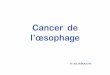 Cancer de l’œsophage - التعليم الجامعيuniv.ency-education.com/uploads/1/3/1/0/13102001/gastro4an-cancer... · oesophagite peptique ... caustique), un mégaoesophage,