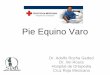 Pie Equino Varo - pediatrasyucatan.org.mxpediatrasyucatan.org.mx/docs/presentaciones/pie_equino_varo... · / Del desarrollo •Niño sano –Se forma normal –Se deforma en etapa