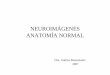 NEUROIMGENES ANATOMA NORMAL - .ANATOMA NORMAL Dra. Andrea Bustamante 2007. A “rbita B Seno