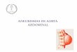 ANEURISMAS DE AORTA ABDOMINAL - asturias.es Publica... · Definición de aneurisma de aorta abdominal un diámetro igual o superior a ... Se pueden palpar, si el ... define el cribado