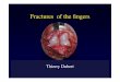 Fractures of the ﬁngers - ClubOrtho.fr · Fractures of the ﬁngers Thierry Dubert. Recent Fractures large bone fragment Deﬁnitions ... –Volar plate arthroplasty. Palmar Base