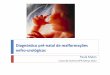 Diagnóstico pré-natal de malformações nefro-urológicas ... · das crianças que apresentam hidronefrose moderada e ... 3 - ectasia dos pequenos cálices entre 4 e 8 mm 4 –