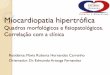 Miocardiopatia hipertrófica · Conceito “Ventrículo esquerdo hipertrofiado, não dilatado, na ausência de outras condições cardíacas ou sistêmicas de produzir hipertrofia