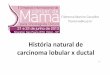 História natural de carcinoma lobular x ductal · de mama Carcinoma invasivo de tipo não ... – Mucinoso – Com ... Tamanhotumor, mediana 4,5 cm 3,4 cm