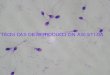 TÉCNICAS DE · Contacto de óvulos y espermatozoides en microgota. ... Conservación de la fertilidad en mujeres con riesgo de perder su función gonadal
