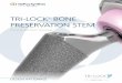 TRI-LOCK BONE PRESERVATION STEMsynthes.vo.llnwd.net/o16/LLNWMB8/US Mobile/Synthes North America... · The TRI-LOCK Bone Preservation Stem achieves axial stability within the femur