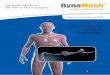 Expert Technologies in PVDF · by FEG Textiltechnik mbH. 1 DynaMesh®-PRM Solución para expertos Los implantes de malla DynaMesh®-PRM han sido ... se evita de forma segura la formación