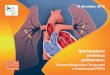 IPERTENSIONE ARTERIOSA POLMONARE - ARTERIOSA...  Ipertensione arteriosa polmonare: 15 dicembre 2016