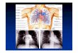 Central hemodynamic findings - .Ipertensione arteriosa polmonare â€¢ Condizione clinica associata