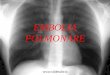 Embolia polmonare - .Si definisce embolia polmonare, o meglio tromboembolia polmonare, una condizione