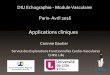 DIU Echographie - Module Vasculaire Paris- Avril 2016naxos.biomedicale.univ-paris5.fr/diue/wp-content/uploads/2013/05/... · MAV temporale droite Nidus EDTC voie temporale droite