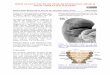 OPEN ACCESS ATLAS OF OTOLARYNGOLOGY, HEAD & … · OPEN ACCESS ATLAS OF OTOLARYNGOLOGY, HEAD & NECK OPERATIVE SURGERY RESECTING BRANCHIAL FISTULAE, SINUSES AND CYSTS Johan Fagan Failure