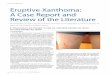 Eruptive Xanthoma: A Case Report and Review of the Literaturepracticaldermatology.com/pdfs/pd1014_ClinicalReports.pdf · dermatitis, dermatitis herpetiformis, lichen planus, granuloma