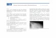 Omuz Sorunlarında Görüntüleme Dr. Ulunay Kanatlıulunaykanatli.com/UserFiles/goruntuleme.pdf · 2016-03-31 · Akromioklavikular hipertrofi yine bu kesitlerde gözlenir. Korakoakromial