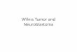 Wilms Tumor and Neuroblastoma - Assiut lectures/wilms tumor and    Neuroblastoma