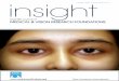 Scientiﬁ c Journal of MEDICAL & VISION RESEARCH … Files/insight_october... · It generally affects neutropenic patients.12 Clinical features Both preseptal and post septal orbital