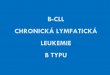 PRINCIPY HODNOCENÍ KREVNÍHO OBRAZU - int1.lf1.cuni.cz · Diferenciální diagnosa B-CLL Odlišení od ostatních lymfoproliferací pomocí morfologie a immunophenotypisace. Nutno