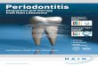 Periodontitis as an Infectious Disease - virogena.hr · 2 Periodontitis as an Infectious Disease It is now certain that a definite group of highly pathogenic bacteria is the primary