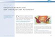 Neue Techniken bei der Therapie der Analﬁ stel · Fistel-Plug (Anal Fistula Plug – AFP) ... mumab injection in patients with ﬁ stulizing perianal Crohn’s disease: a pilot