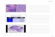 Immature Teratoma Histologic Grading - Pathologypathology.ucsf.edu/uploads/376/201_PP Part 2 Case 14c.pdf · 5/25/2012 24 Significance of Microscopic Foci of Immaturity in a Benign