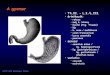 A gastrointestinalis tractus képalkotó diagnosztikája · PDF fileSZTE ÁOK Radiológiai Klinika Gyomor betegségek: • külső compressio • hyperaciditás, ulcus • diverticulum