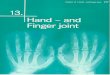 fileb) 2. 3. Chapter 13 | Hand - Nerve Blockade Blockade of the nervus medianus Blockade of the nervus ulnaris Blockade of the nervus radialis and Finger joint