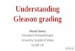 Consultant Histopathologist University Hospital of Wales · •esp. pattern 3 vs 4 ... Most common issue in Gleason grading Understanding rather than learning is the key! •Understand