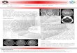 UNIVERSIDADE ESTADUAL DE CAMPINAS - UNICAMP filePrimary Vasculitis of the Central Nervous System: Report and Case Discussion Rigon, B.G.S.¹; Souza, L. S. S.²; Katsurayama, M.¹;