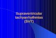 Supraventricular tachyarrhythmias (SVT)Conducting system of the heart SA node-physiological pacemaker located in the right atrium (near the opening of the superior vena cava). -comprises