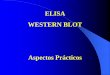 ELISA WESTERN BLOT - WordPress.com · Estudiar perfil de citocinas en modelos experimentales. Diagnóstico: Prueba confirmatoria de VIH Se emplea como prueba definitiva de la encefalopatía