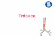 Tráquea · 2017-06-02 · Formada por cartílagos traqueales (anillos), convexos adelante y abiertos hacia atrás. En el origen de los bronquios, el armazón cartilagnoso dispone
