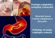 Patologia amigdalelor, esofagului, . . Patologia... · PDF file Patologia amigdalelor, esofagului, stomacului. Болезни зева и глотки, пищевода и желудка