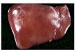 Prezentácia programu PowerPoint · HCV (ca. (29, 67, 69, 82) • HDV superinfection ... Pancreas Pancreatitis, particularly in acetaminophen-related disease Adrenal gland ... (caput