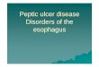 Peptic ulcer disease Disorders of the ... Peptic ulcer disease Disorders of the esophagus. Peptic ulcer disease Burning epigastric pain Exacerbated by fasting Improved with meals Ulcer: