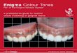 The Enigma Denture System comprises of Enigma Denture Teeth, Enigma High-Base impact resistant acrylic,
