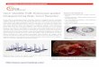 Vycor ViewSite TC®: Endoscope-guided Intraparenchimal ...€¦ · Vycor ViewSite TC®: Endoscope-guided Intraparenchimal Brain Tumor Resection ... with several diameter options,