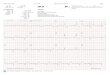 Test Report - ECG WALLETshoppingcart.ecgwallet.com/shop/Resting_Sample_Rpt.pdf · p Axis. QRS Axis. T Axis Sokolow Lyon: Cornell: Estes Sinus bradycardia ( < 60 beats per minute)