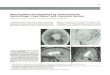 Neurocytoma Accompanied by Intraventricular Hemorrhage: Case · PDF file 2014-05-12 · Neurocytoma Accompanied by Intraventricular Hemorrhage: Case Report and Literature Review Wendy