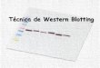 Técnica de Western Blotting · PDF file Western Blotting (Immunoblotting) Método utilizado para a imunodetecção de proteínas após sua separação por eletroforese em gel e transferência