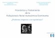 Poliquistosis Renal Autosómica Dominantea/Nefro Medi… · Recomendó efectuar ensayosdonde el punto final primario (primary. end point) fuerael filtrado glomerular, paralo cual