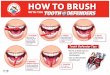 HOW TO BRUSH...toothpaste! • Use a soft-bristled toothbrush! Tooth Defender Tips 3. BACK Brush chewing surface of each tooth. 2. INSIDE Brush inside surface of each tooth, using