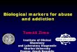 Biological markers for abuse and addiction markers alko Vilach... · alcoholism • Patient´s ... • IgA increase 69% alcohol liver diseases • Lipids – HDL, TG 80% increase